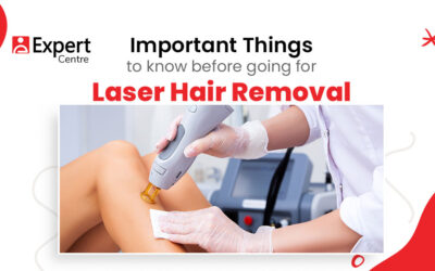 Important things to know before going for laser hair removal