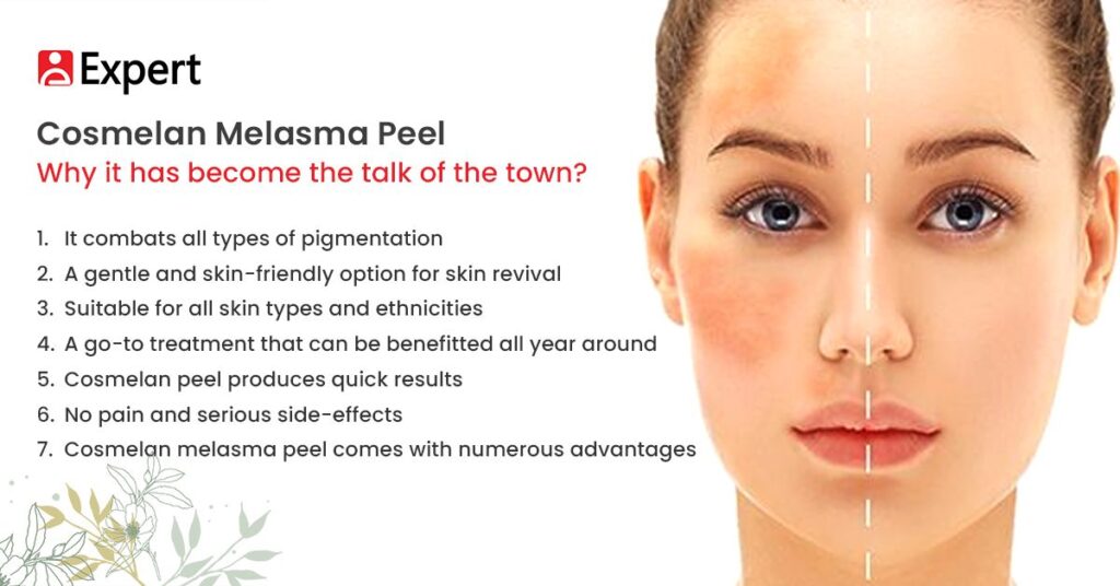 Cosmelan Melasma Peel