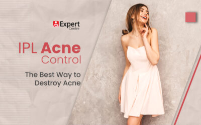 IPL Acne Control: The Best Way to Destroy Acne