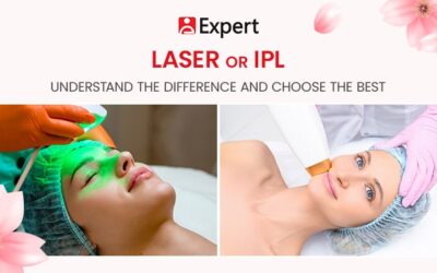 Laser or IPL: Understand the Difference and Choose the Best