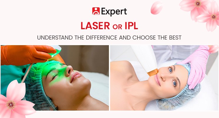 Laser or IPL: Understand the Difference and Choose the Best