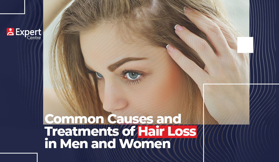 Common Causes and Treatments of Hair Loss in Men and Women