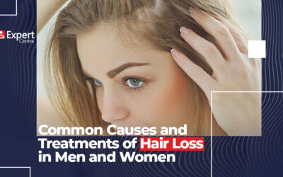 Common Causes and Treatments of Hair Loss in Men and Women