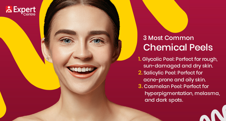 Chemical Peels 