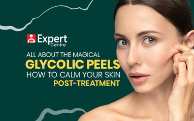 All About the Magical Glycolic Peels and How to Calm Your Skin Post-Treatment