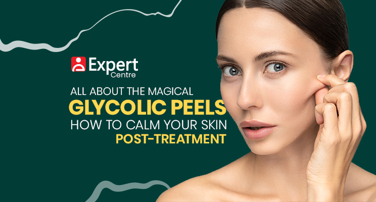 All About the Magical Glycolic Peels and How to Calm Your Skin Post-Treatment