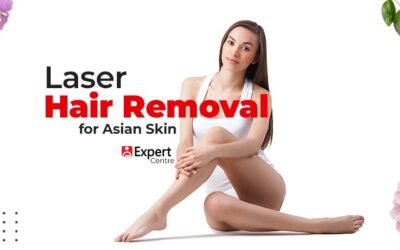 Laser Hair Removal for Asian Skin