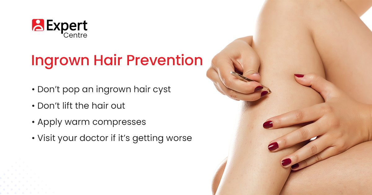 Ingrown Hair Prevention