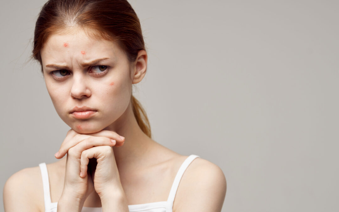 Intense Pulsed Light Treatment: Does it work for Acne?