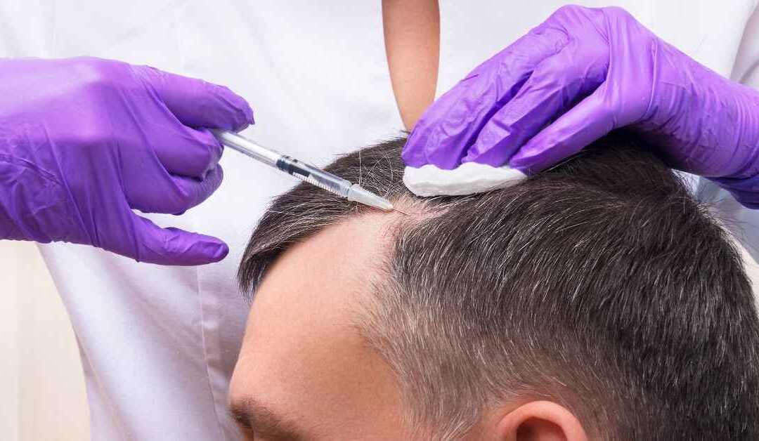 Get PRP Hair Treatment Cost UK