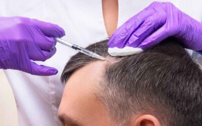 How Much Does PRP Hair Treatment Cost?