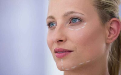 Most Common Questions About HIFU Facelift Treatment Answered